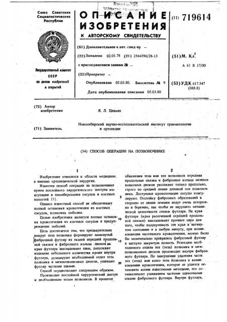 Способ операции на позвоночнике (патент 719614)