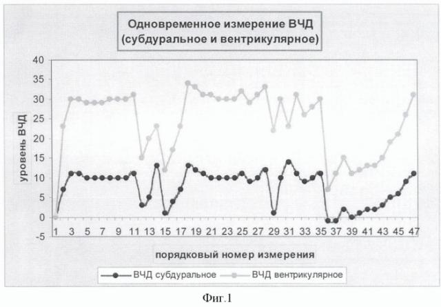 Способ определения причин внутричерепной гипертензии в остром периоде субарахноидального кровоизлияния после разрыва артериальных аневризм (патент 2372027)