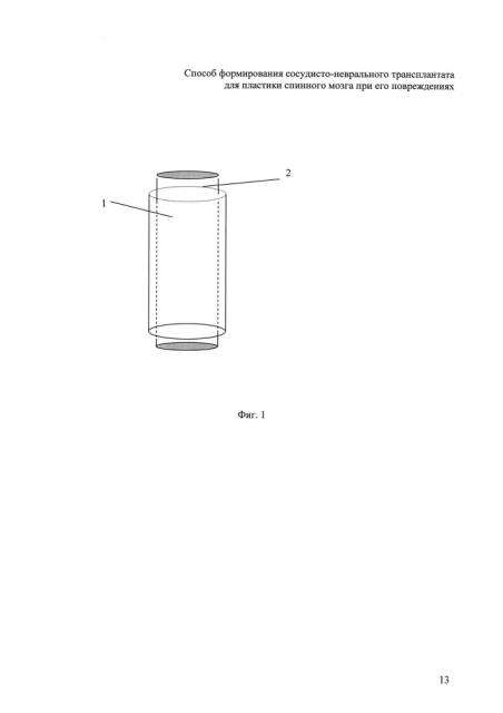 Способ формирования аутовенозно-неврального трансплантата для пластики спинного мозга при его повреждениях (патент 2622634)