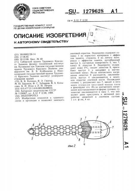 Эндопротез (патент 1279628)