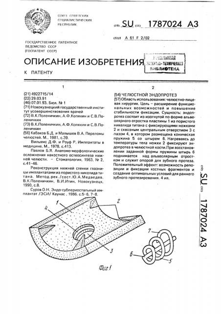 Челюстной эндопротез (патент 1787024)