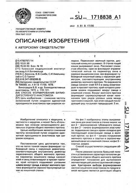 Способ формирования билиодигестивного анастомоза (патент 1718838)