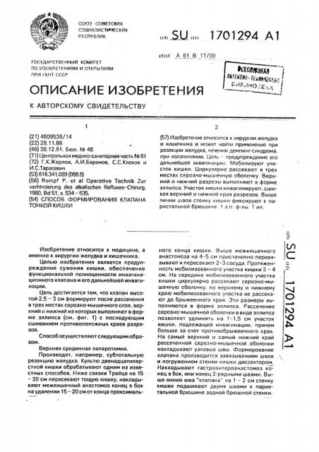 Способ формирования клапана тонкой кишки (патент 1701294)