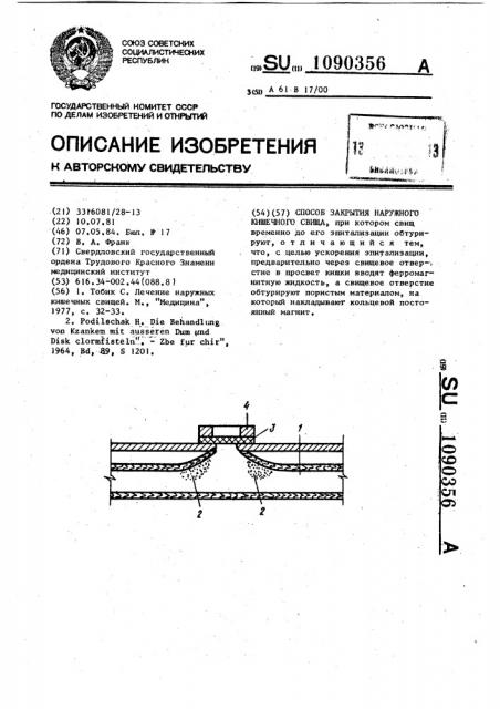 Способ закрытия наружного кишечного свища (патент 1090356)