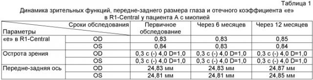 Способ прогнозирования прогрессирования приобретенной миопии у детей (патент 2471423)