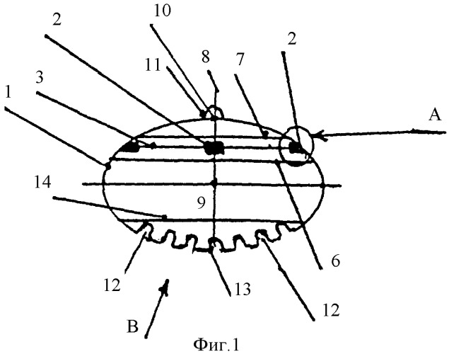 Устройство формирования опорно-двигательной культи для энуклеации при субатрофии глазного яблока и окружающих его тканей (патент 2348385)