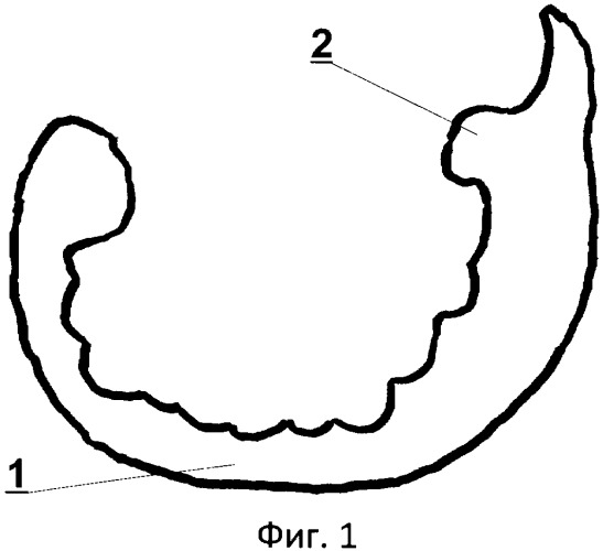 Пластинка-обтуратор (патент 2358686)