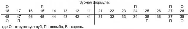 Способ оперативного лечения абсцессов и флегмон окологлоточного пространства (патент 2352266)