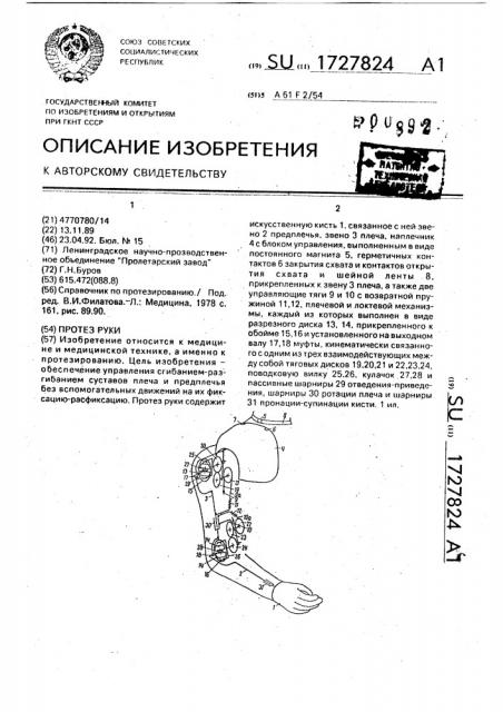 Протез руки (патент 1727824)