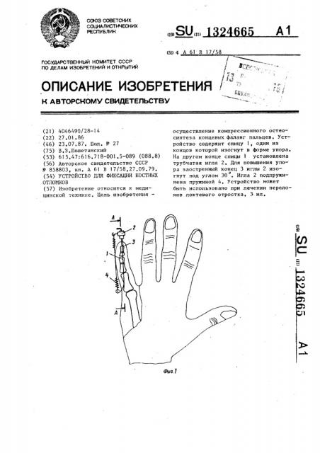 Устройство для фиксации костных отломков (патент 1324665)