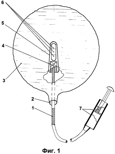 Способ измерения давления в мочевом пузыре и устройство для его осуществления лобкарева а.о. и лобкарёва о.а. (патент 2491893)