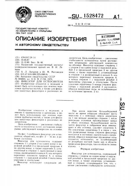 Фиксатор для остеосинтеза (патент 1528472)