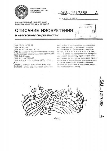Способ торакопластики при сколиозе (патент 1217388)