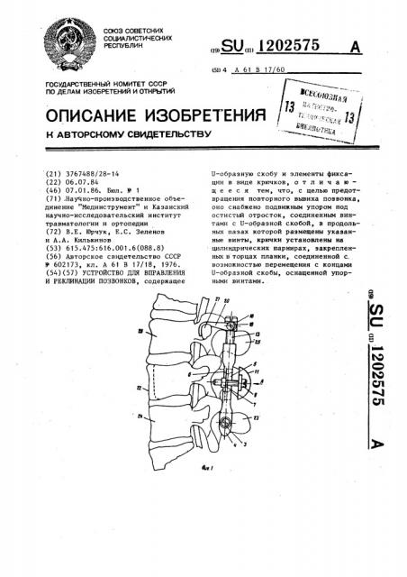 Устройство для вправления и реклинации позвонков (патент 1202575)