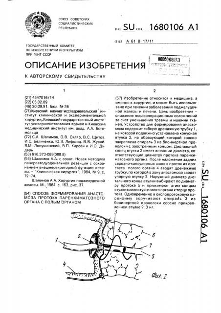 Способ формирования анастомоза протока паренхиматозного органа с полым органом (патент 1680106)