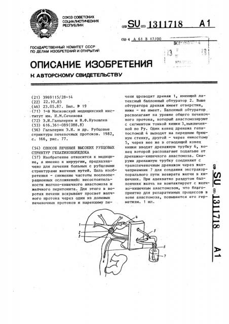 Способ лечения высоких рубцовых стриктур гепатикохоледоха (патент 1311718)