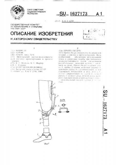 Протез бедра (патент 1627173)