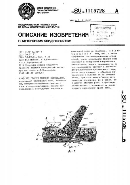 Способ лечения эвентрации (патент 1115728)