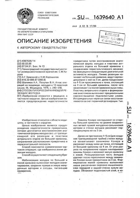 Способ пилоросохраняющей резекции желудка (патент 1639640)