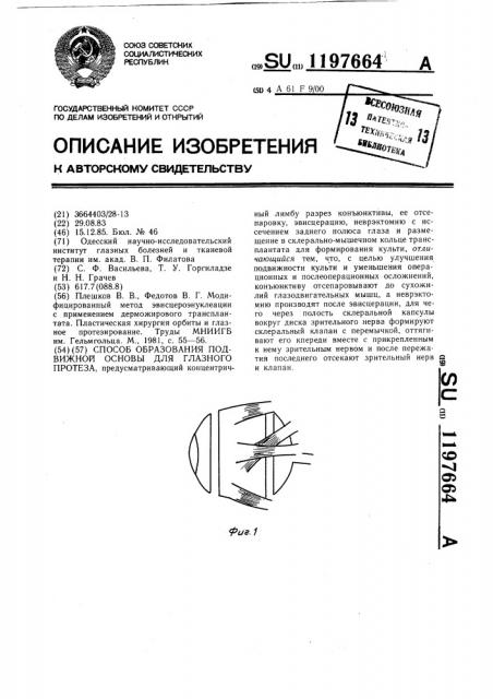 Способ образования подвижной основы для глазного протеза (патент 1197664)