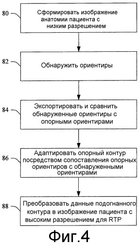Автоматизированное оконтуривание анатомии для планирования терапии с управлением по изображениям (патент 2541887)