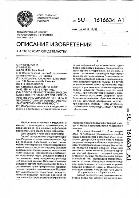 Способ реконструкции проксимального отдела бедра при изменении шеечно-диафизарного угла с высоким стоянием большого вертела с укорочением конечности (патент 1616634)