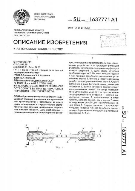 Устройство для компрессионного остеосинтеза при центральных переломах нижней челюсти (патент 1637771)