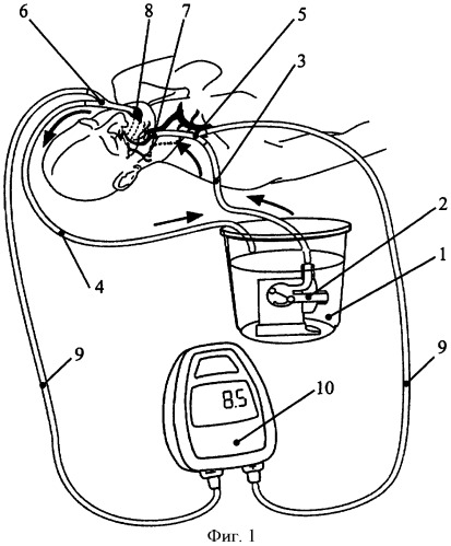 Способ оценки в эксперименте гемодинамики экстракраниального отдела внутренней сонной артерии человека и устройство для реализации способа (патент 2408935)