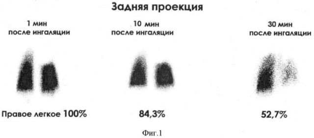 Способ оценки нарушений вентиляции и перфузии в раннем послеоперационном периоде при радикальных вмешательствах на легких у онкологических больных (патент 2391910)