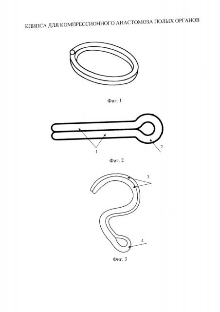 Клипса для компрессионного анастомоза полых органов (патент 2664188)