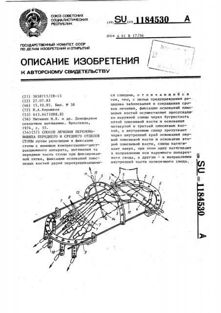 Способ лечения перелома-вывиха переднего и среднего отделов стопы (патент 1184530)