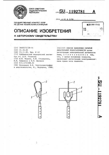 Способ выявления скрытой дыхательной недостаточности (патент 1192781)