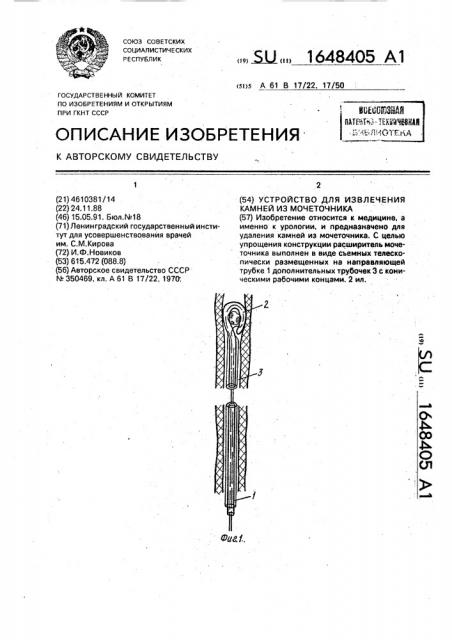 Устройство для извлечения камней из мочеточника (патент 1648405)