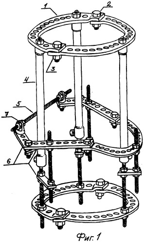 Аппарат для первичного внеочагового остеосинтеза переломов голени (патент 2264188)