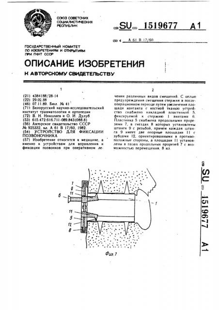 Устройство для фиксации позвоночника (патент 1519677)