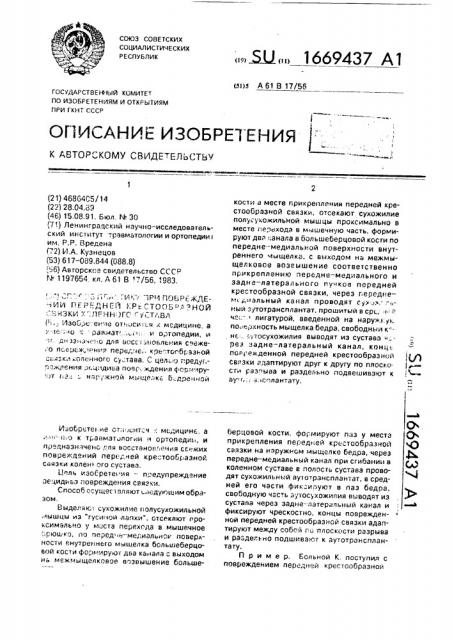 Способ пластики при повреждении передней крестообразной связки коленного сустава (патент 1669437)