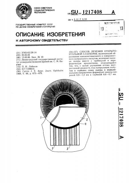 Способ лечения открытоугольной глаукомы (патент 1217408)