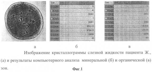 Способ дифференциальной диагностики инфекционно-воспалительных осложнений при травме глаза (патент 2356053)