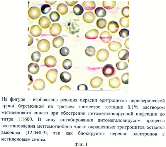 Способ оценки индуцирующего действия цитомегаловирусной инфекции на содержание метгемоглобина в эритроцитах периферической крови беременных на третьем триместре гестации (патент 2499260)