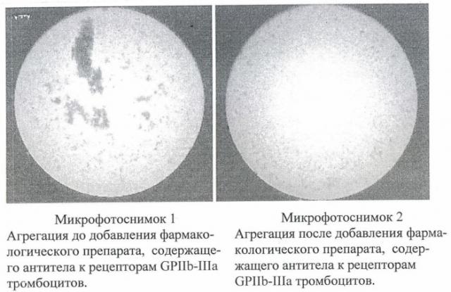 Способ исследования агрегации тромбоцитов (патент 2421724)