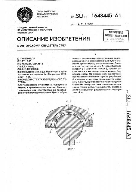 Эндопротез тазобедренного сустава (патент 1648445)