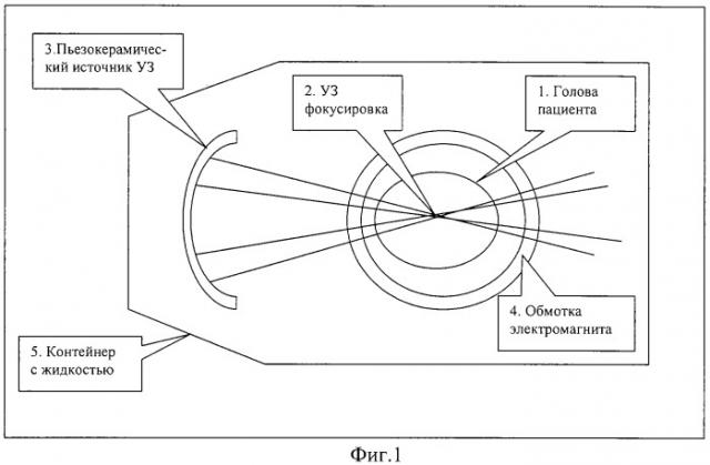 Стимуляция биологических тканей с помощью магнитоакустического воздействия (патент 2316368)