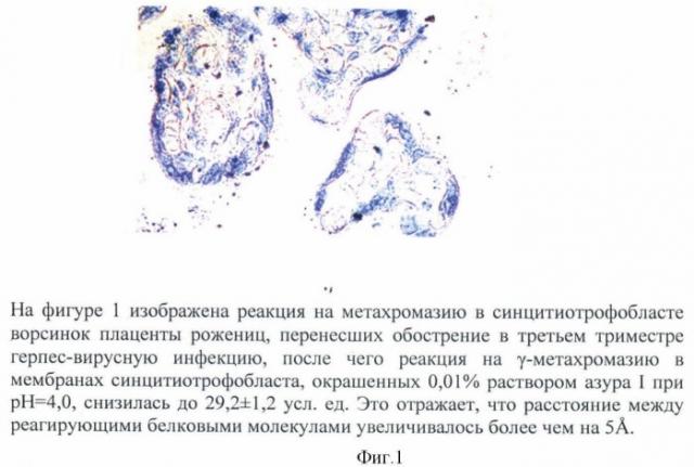 Способ оценки проницаемости мембраны синцитиотрофобласта ворсинок плаценты методом метахромазии у рожениц, перенесших в третьем триместре обострение герпес-вирусной инфекции с титром антител 1:12800 (патент 2463604)