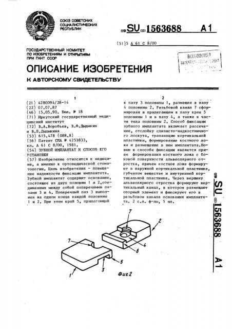 Зубной имплантат и способ его установки (патент 1563688)