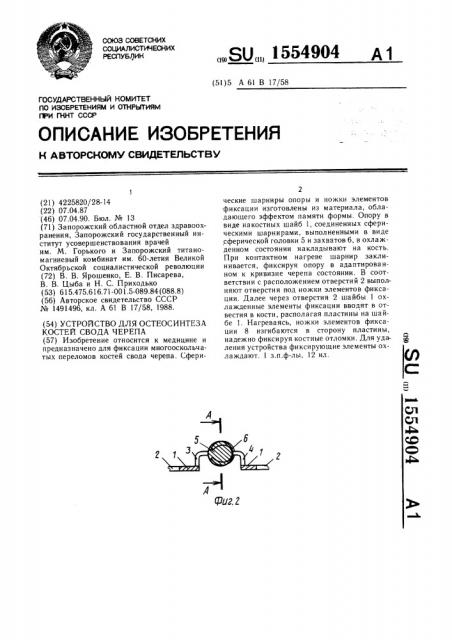 Устройство для остеосинтеза костей свода черепа (патент 1554904)