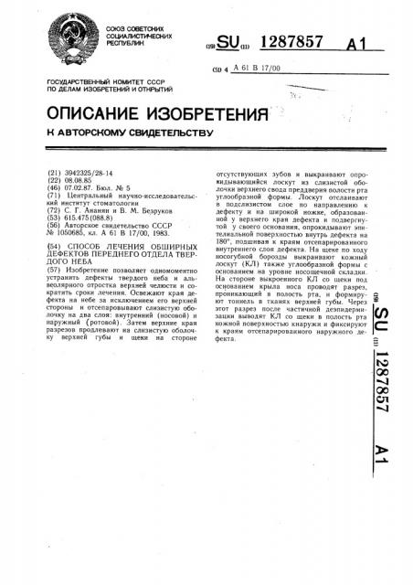 Способ лечения обширных дефектов переднего отдела твердого неба (патент 1287857)