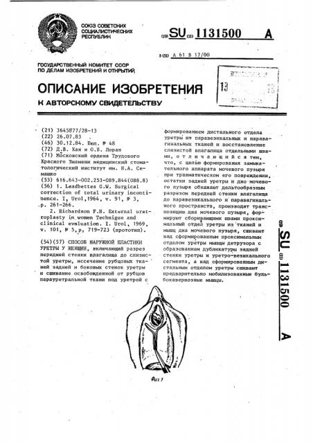 Способ наружной пластики уретры у женщин (патент 1131500)