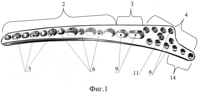 Пластина задняя дистальная комбинированная для остеосинтеза плечевой кости (патент 2599193)