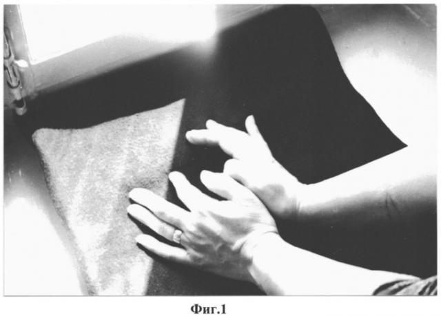 Способ формирования ногтевой фаланги i пальца кисти (патент 2548517)