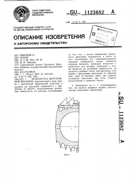 Эндопротез вертлужной впадины (патент 1123682)